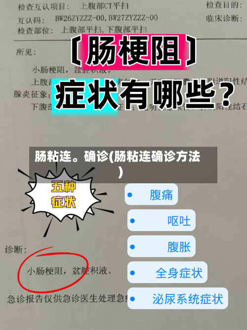 肠粘连	。确诊(肠粘连确诊方法)-第3张图片