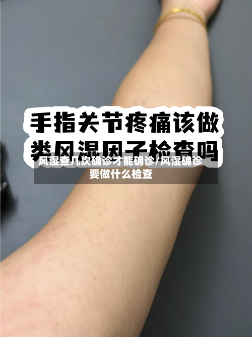 风湿查几次确诊才能确诊/风湿确诊要做什么检查-第3张图片