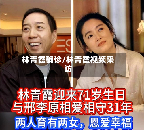 林青霞确诊/林青霞视频采访-第2张图片