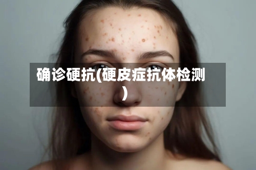 确诊硬抗(硬皮症抗体检测)-第1张图片
