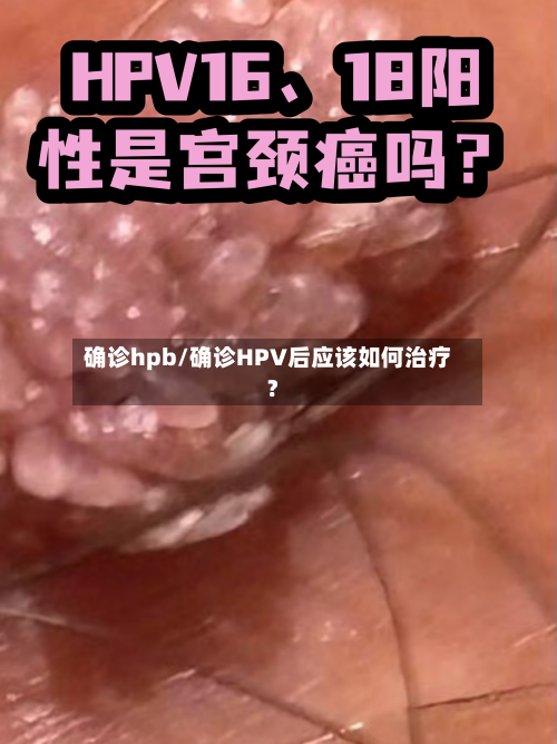 确诊hpb/确诊HPV后应该如何治疗?