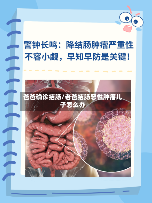 爸爸确诊结肠/老爸结肠恶性肿瘤儿子怎么办-第3张图片