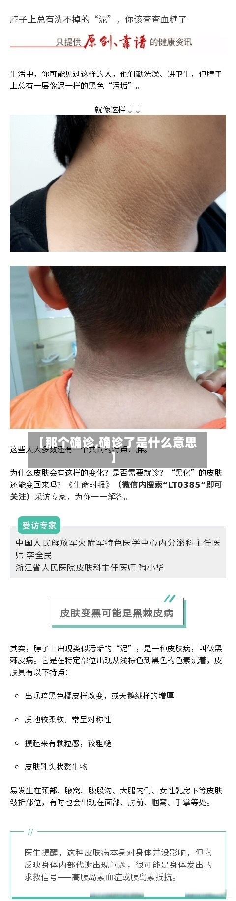 【那个确诊,确诊了是什么意思】
