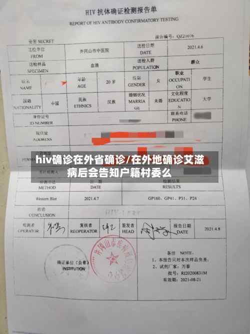 hiv确诊在外省确诊/在外地确诊艾滋病后会告知户籍村委么