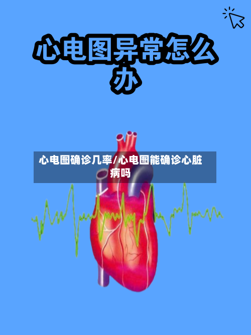 心电图确诊几率/心电图能确诊心脏病吗-第3张图片