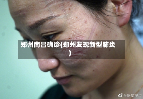 郑州南昌确诊(郑州发现新型肺炎)-第2张图片