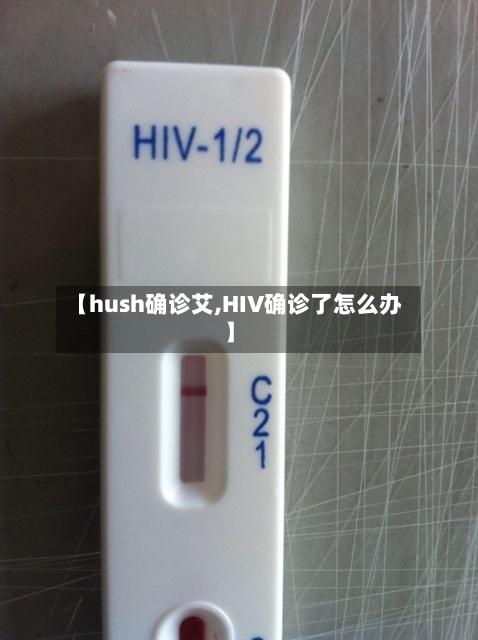 【hush确诊艾,HIV确诊了怎么办】-第2张图片