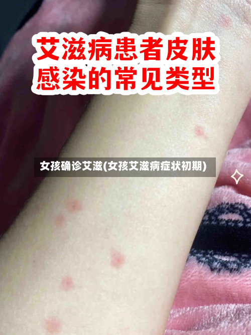 女孩确诊艾滋(女孩艾滋病症状初期)