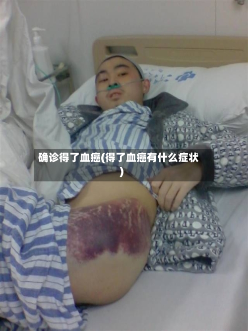 确诊得了血癌(得了血癌有什么症状)