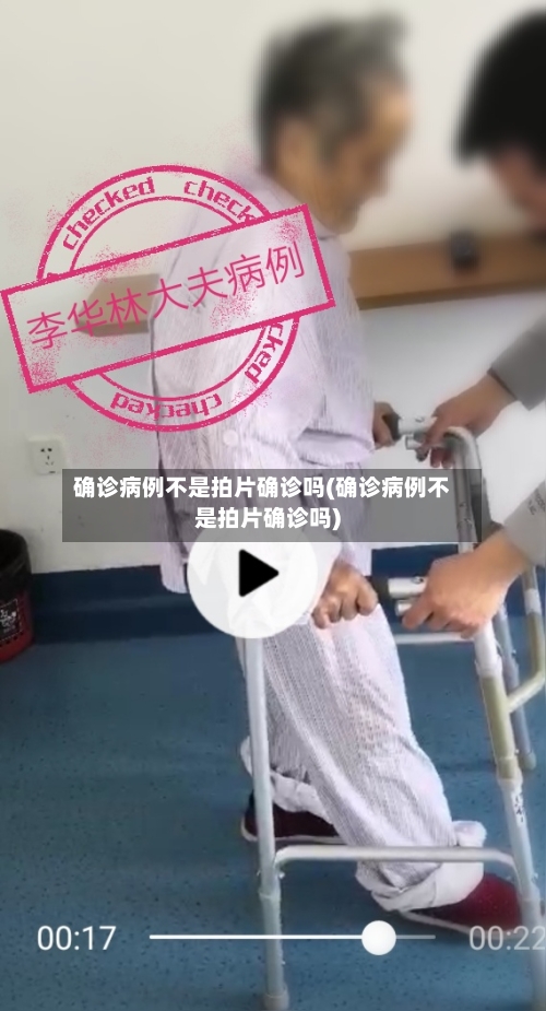 确诊病例不是拍片确诊吗(确诊病例不是拍片确诊吗)