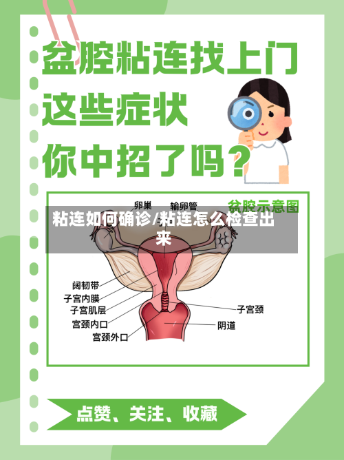 粘连如何确诊/粘连怎么检查出来