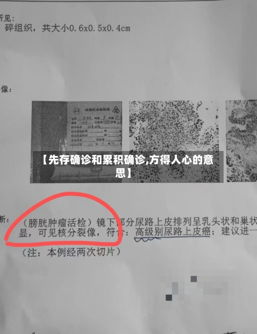 【先存确诊和累积确诊,方得人心的意思】-第2张图片