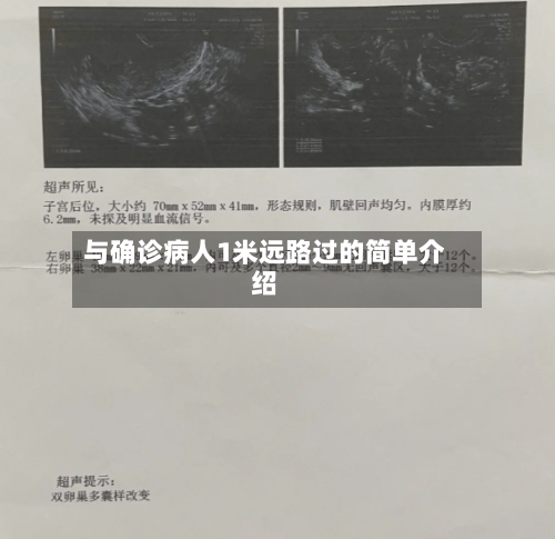 与确诊病人1米远路过的简单介绍-第2张图片