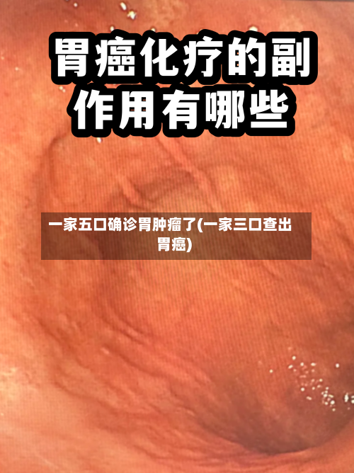 一家五口确诊胃肿瘤了(一家三口查出胃癌)