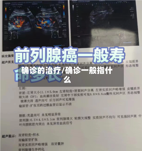 确诊的治疗/确诊一般指什么