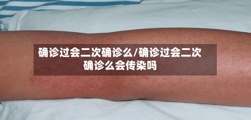 确诊过会二次确诊么/确诊过会二次确诊么会传染吗-第2张图片