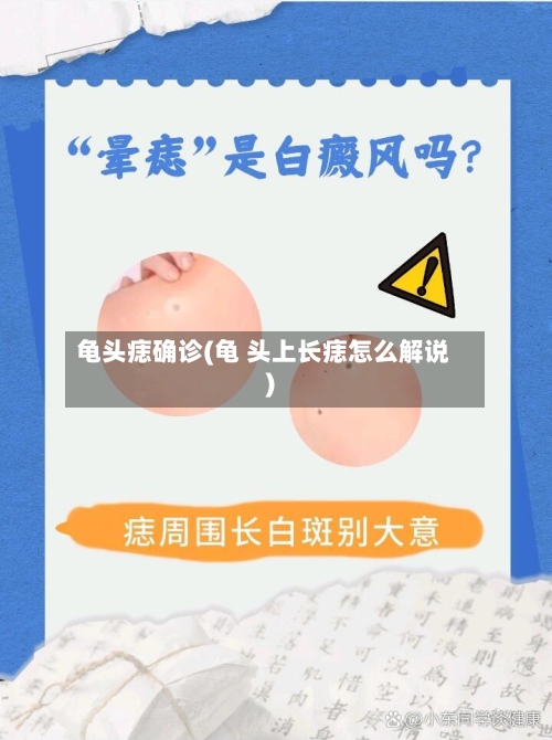龟头痣确诊(龟 头上长痣怎么解说)-第2张图片