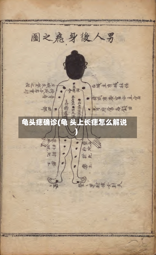 龟头痣确诊(龟 头上长痣怎么解说)