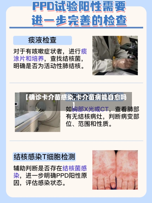 【确诊卡介苗感染,卡介苗病能自愈吗】-第2张图片