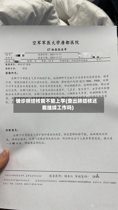 确诊肺结核能不能上学(查出肺结核还能继续工作吗)-第3张图片