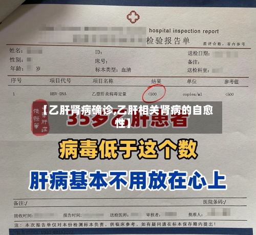 【乙肝肾病确诊,乙肝相关肾病的自愈性】-第3张图片