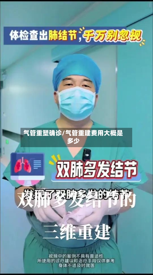气管重塑确诊/气管重建费用大概是多少-第2张图片