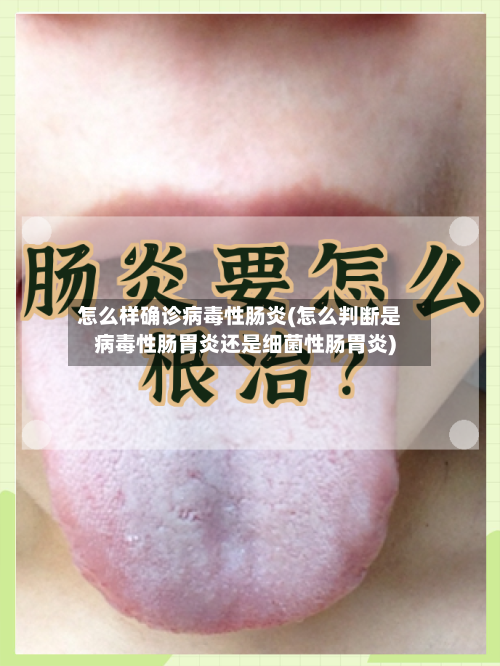 怎么样确诊病毒性肠炎(怎么判断是病毒性肠胃炎还是细菌性肠胃炎)-第3张图片