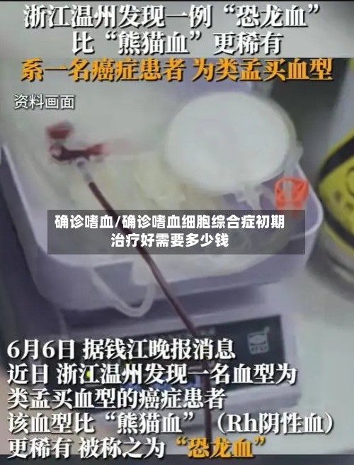 确诊嗜血/确诊嗜血细胞综合症初期治疗好需要多少钱