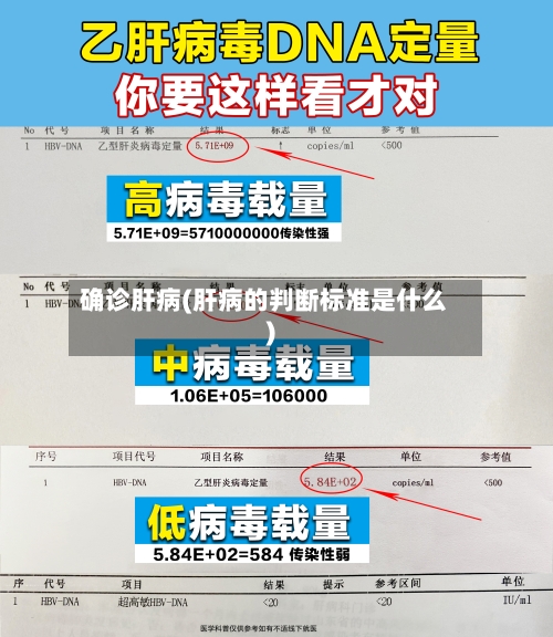 确诊肝病(肝病的判断标准是什么)