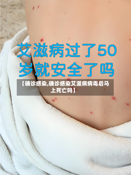 【确诊感染,确诊感染艾滋病病毒后马上死亡吗】