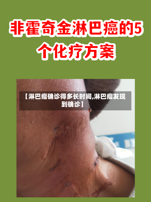 【淋巴瘤确诊得多长时间,淋巴瘤发现到确诊】