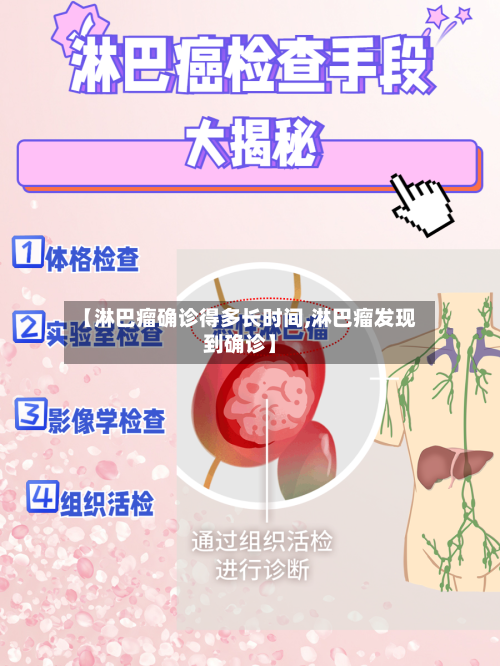 【淋巴瘤确诊得多长时间,淋巴瘤发现到确诊】-第2张图片