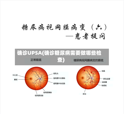 确诊UPSA(确诊糖尿病需要做哪些检查)-第3张图片
