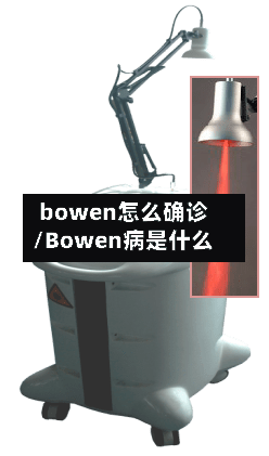 bowen怎么确诊/Bowen病是什么