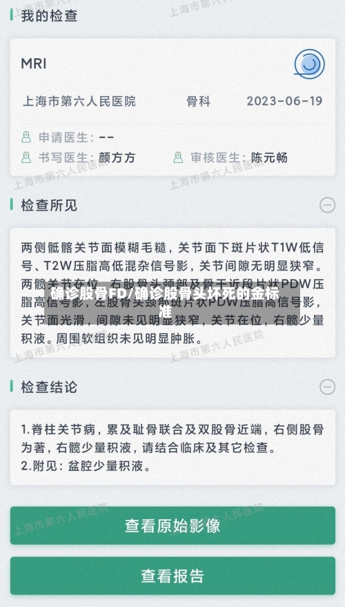 确诊股骨FD/确诊股骨头坏死的金标准
