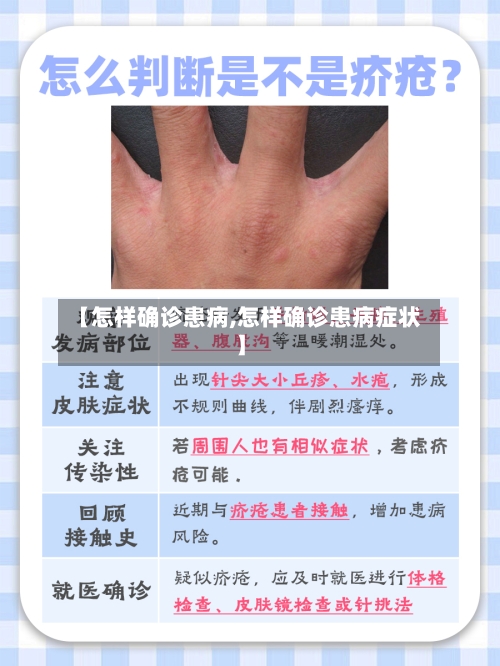 【怎样确诊患病,怎样确诊患病症状】-第2张图片