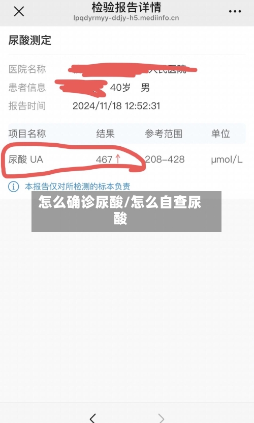 怎么确诊尿酸/怎么自查尿酸-第1张图片