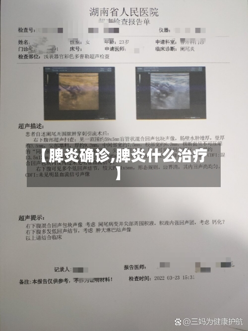 【脾炎确诊,脾炎什么治疗】-第2张图片
