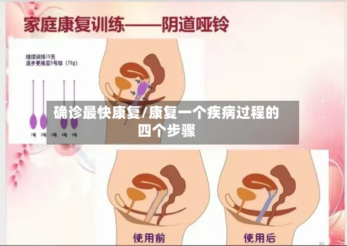 确诊最快康复/康复一个疾病过程的四个步骤