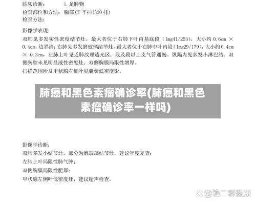 肺癌和黑色素瘤确诊率(肺癌和黑色素瘤确诊率一样吗)