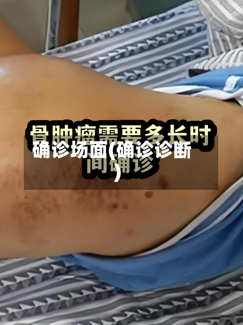 确诊场面(确诊诊断)-第3张图片