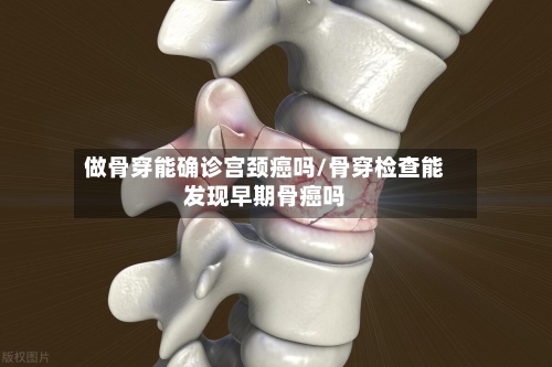 做骨穿能确诊宫颈癌吗/骨穿检查能发现早期骨癌吗-第3张图片