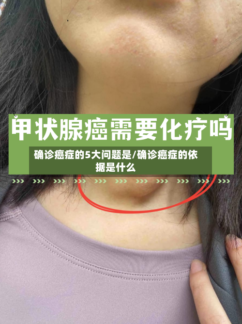 确诊癌症的5大问题是/确诊癌症的依据是什么