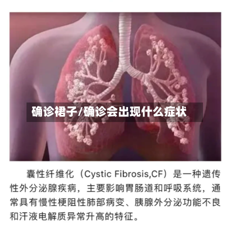 确诊裙子/确诊会出现什么症状