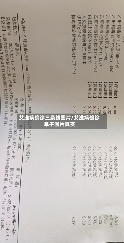 艾滋病确诊三条线图片/艾滋病确诊单子图片真实-第2张图片