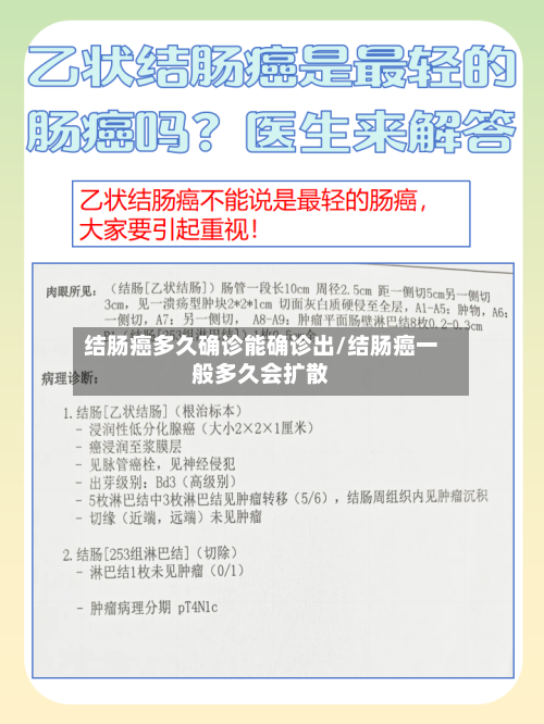结肠癌多久确诊能确诊出/结肠癌一般多久会扩散