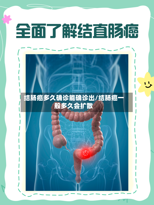 结肠癌多久确诊能确诊出/结肠癌一般多久会扩散-第3张图片