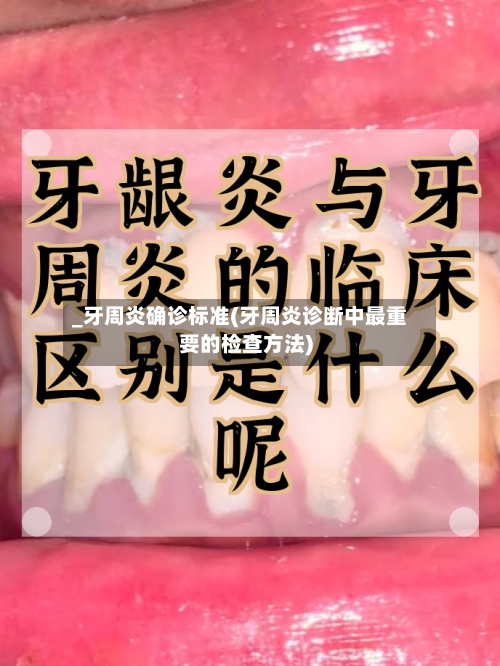 _牙周炎确诊标准(牙周炎诊断中最重要的检查方法)-第2张图片