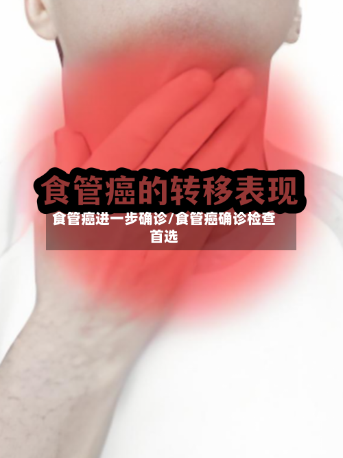 食管癌进一步确诊/食管癌确诊检查首选