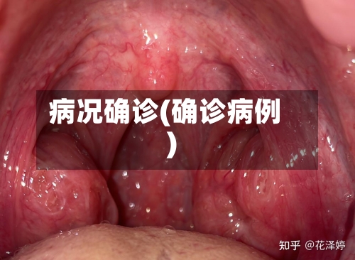 病况确诊(确诊病例)